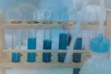 Concept Coronavirus.  scientist or doctor research for Corona virus treatment drug And research in lab Or hospital.