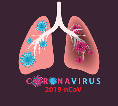 Coronavirus banner for awareness & alert against disease spread, symptoms or precautions. Corona virus design with infected lungs and virus microscopic view background. Respiratory system