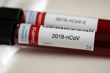 Coronavirus blood sample testing in tube