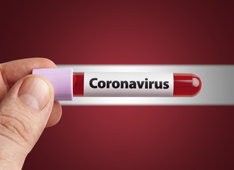 Obraz premium Scientist holding Coronavirus infected blood in test tube in front of Latvia flag. Pandemic COVID-19 infection in countries in world concept.