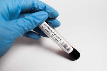 Coronavirus blood test. Doctor holding a test tube. 2019-nCoV. Covid.
