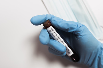 Coronavirus blood test. Doctor holding a test tube. 2019-nCoV. Covid.