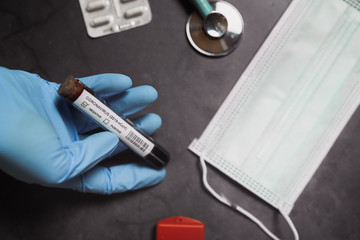 Coronavirus blood test positive. Doctor holding a test tube. 2019-nCoV. Covid.