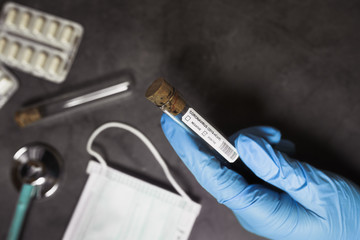 Coronavirus concept. Coronavirus test, thermometer, pills, stethoscope,  laboratory desk. 2019-nCoV