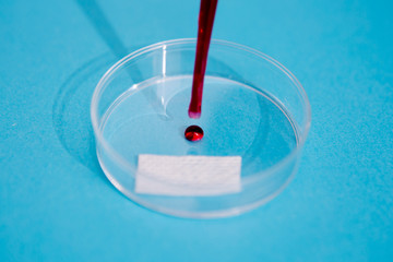 Coronavirus disease (COVID-19) blood sample in laboratory. Virus sample in laboratory. 
