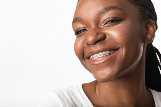 Portrait Of Girl In Braces Smiling To Camera, Studio Shot