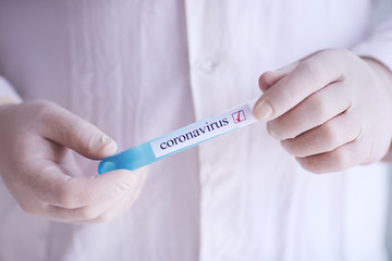 Obraz premium Coronavirus 2019-nCoV Sample. medical nurse holding test-tube. Epidemic disease