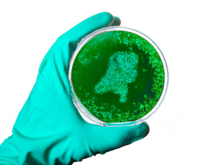 Germs in the shape of Netherlands in a petri dish.(series)