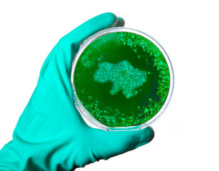 Germs in the shape of Ukraine in a petri dish.(series)