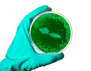 Germs in the shape of Samoa in a petri dish.(series)