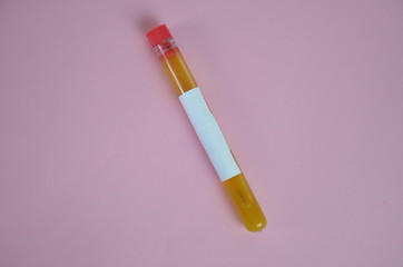 Colored liquids yellow in test tubes over pink background