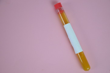 Colored liquids yellow in test tubes over pink background