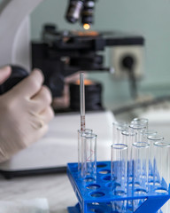 Laboratory tests for the presence of coronavirus COVID-19. Blood test in the hospital.