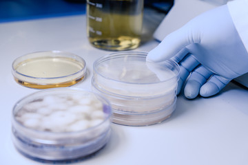 Scientific handling Microbiological cultures in a petri dish for pharmaceutical bioscience...
