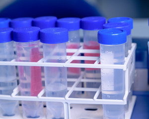 Laboratory test tubes in rack. Concept of science, laboratory and study of diseases.