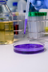 Pipette with drop of color liquid and petri dishes. Concept of science, laboratory and study of diseases.