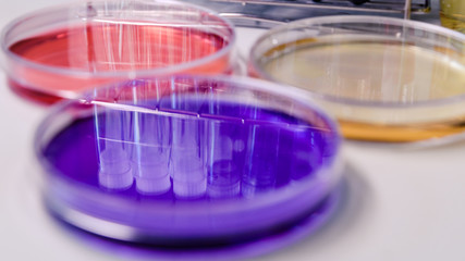 Petri dishes, test tubes and laboratory equipment, with coloring liquids. Concept of science, laboratory and study of diseases.