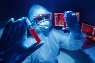 Workers scientist biological laboratory analyzes virus strain model of MERS-Cov coronavirus 2019-nCoV. Blue background