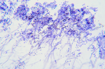 Penicillium branches, ascomycetous fungi under the microscope. To humans ascomycetes are a source...