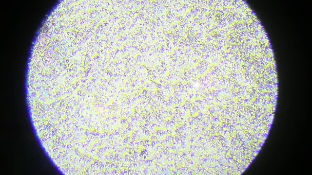 Sperm cells under the microscope