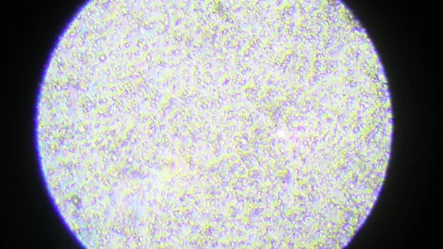 Sperm cells under the microscope