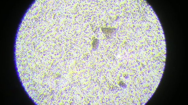 Sperm cells under the microscope