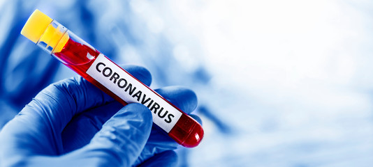 Obraz premium Doctor holding a positive blood test result of coronavirus.