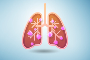 Fototapeta premium Illustration of lungs infected with coronavirus