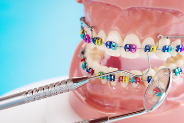 Close up dentist tools and orthodontic model  - demonstration teeth model of varities of...