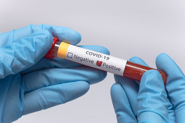Fototapeta premium Blood positive test to coronavirus. Medical reseach, test-tube with blood, hand in latex medical gloves. Coronavirus outbreak and influenza. 2019-nCoV, covid-19, sars. High quality photo. 
