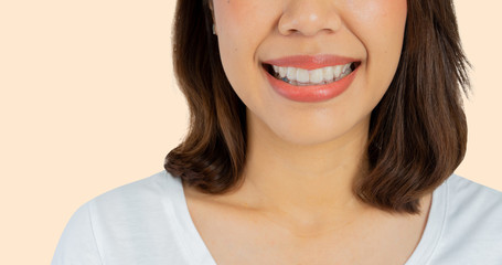 close up young beautiful asian woman smiling with dental aligner retainer tool (invisible) isolated on cream  color background of dental clinic for beautiful teeth treatment course concept	
