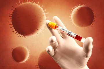 Blood Sample in a flask for analyzing Corona virus and producing vaccine. Corona virus outbreaking. 