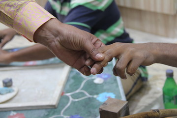 Distorted Fingers due to Stone Work