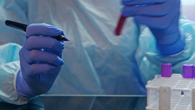 Coronavirus disease. Clinical research. Technician in gloves marking blood samples in tubes.