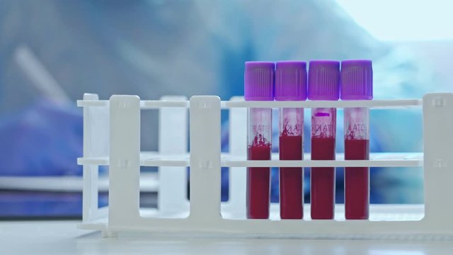 COVID-19 outbreak. Blood test. Nurse working with serum samples in tubes.