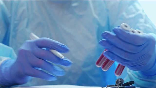 COVID-19 infection. Blood test. Nurse in gloves studying serum samples recording results.