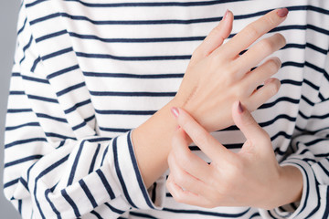 A woman applying scars removal cream to heal the first degree - heat burn wound on her hand....