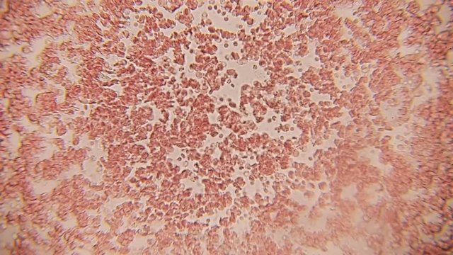 Blood Cell Channel 100x (HD 60p). Blood Platelets seen forming a small pathway at 100x magnification with the aid of a halogen bacteriological microscope.