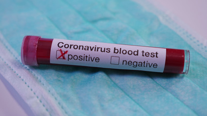 Close up of positive Coronavirus blood test on green medical mask. Concept: COVID-2019 virus protection, Stop spreading epidemic, Wuhan virus and world pandemic, medical protection.