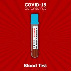 test tube containing blood that tested positive for Novel coronavirus COVID-19 in the blood