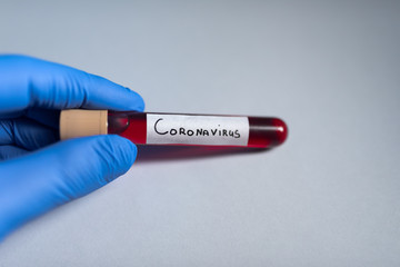 Obraz premium Test tube with coronavirus 