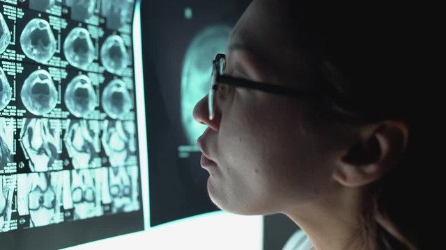 Medical specialist analyzing tomographic image, making diagnosis, analysis