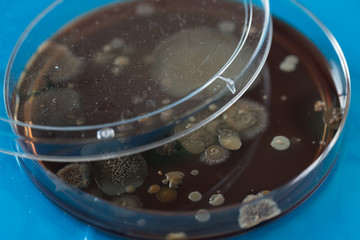 Petri dish with colonies of bacteria