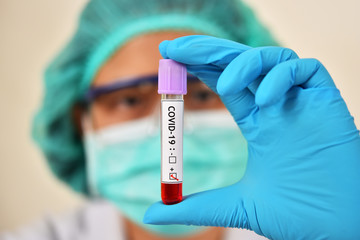 Lab technician holding blood sample tube positive with COVID-19 test