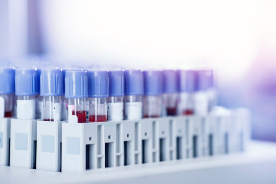 Blood test tube laboratory for analysis with virus epidemic - Powered by Adobe