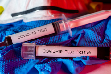 Blood samples that have tested positive for the Coronavirus