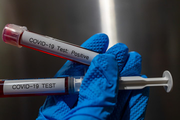 A gloved hand holding blood samples that have tested positive for the Coronavirus 
