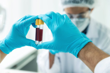 Researchers compare blood samples of patients infected with the disease in the laboratory. Researchers are inventing vaccines to treat COVID-19 virus.