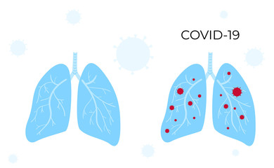 Coronavirus COVID-19. Lungs are healthy and infected with the Chinese virus. Horizontal banner. Symptoms. Human sickness. Colds and inflammation. Pneumonia