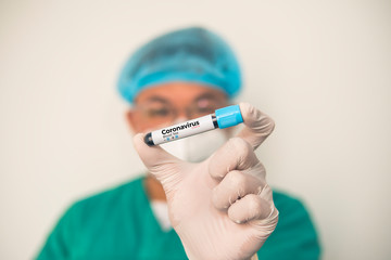 Obraz premium Coronavirus 2019-nCoV Blood Sample. Corona virus outbreaking. Corona Virus in Lab. Scientist hold a tube with Blood Test and Barcode with the Virus Name Coronavirus . New Epidemic Corona Virus